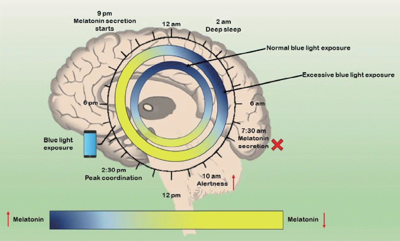 Blocking nocturnal blue light for insomnia: A randomized controlled trial — Shechter et al. — PMC 2018